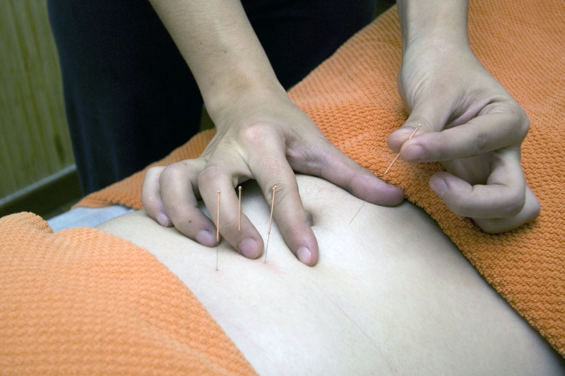 osteopathe-LA ROQUETTE SUR VAR-min_acupuncture-4175625